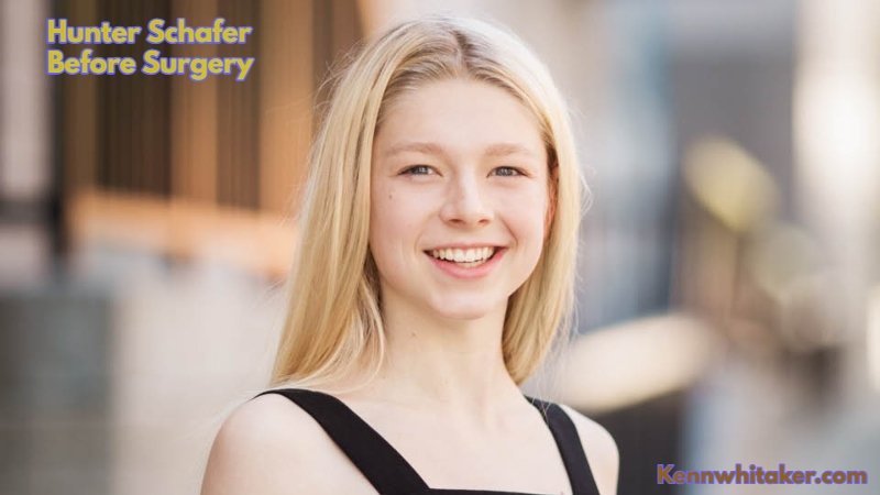 Hunter Schafer Before Surgery