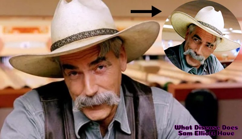 What Disease Does Sam Elliott Have? The Truth Behind the Rumors